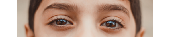 Close up photo of a child's eyes. They are dark brown and looking directly at the camera.
