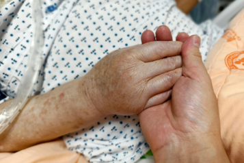 Photo of a hospital patient's hand being held 