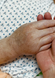 Photo of a hospital patient's hand being held 